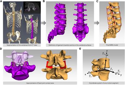 Invasiveness of decompression surgery affects modeled lumbar spine kinetics in patients with degenerative spondylolisthesis